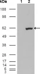 Anti-ER81 antibody [1C8B6] used in Western Blot (WB). GTX83139