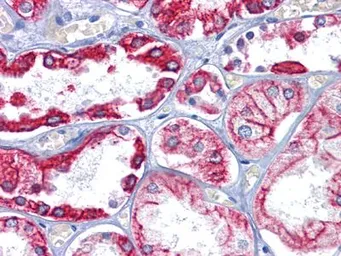 Anti-Cytokeratin 8 antibody [8A5D12] used in IHC (Paraffin sections) (IHC-P). GTX83140