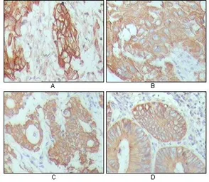 Anti-Cytokeratin 18 antibody [4D11E4] used in IHC (Paraffin sections) (IHC-P). GTX83142