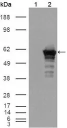 Anti-Desmin antibody [10H7D2] used in Western Blot (WB). GTX83146