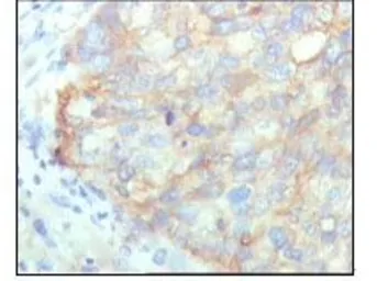 Anti-Lysyl-tRNA synthetase antibody [8G12C1] used in IHC (Paraffin sections) (IHC-P). GTX83186