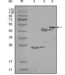 Anti-Lysyl-tRNA synthetase antibody [8G12C1] used in Western Blot (WB). GTX83186