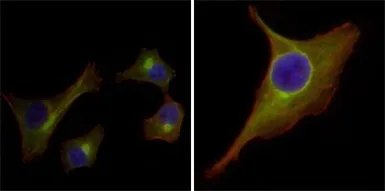 Anti-Cytokeratin 15 antibody [6E7] used in Immunocytochemistry/ Immunofluorescence (ICC/IF). GTX83193