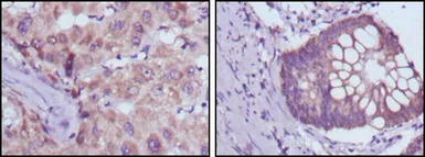 Anti-BDH1 antibody [1A5] used in IHC (Paraffin sections) (IHC-P). GTX83270