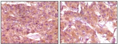 Anti-SRA antibody [1D4H8] used in IHC (Paraffin sections) (IHC-P). GTX83332
