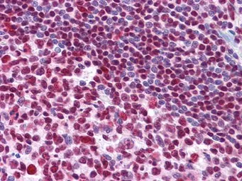 Anti-MDMX / MDM4 antibody [2D10F4] used in IHC (Paraffin sections) (IHC-P). GTX83335
