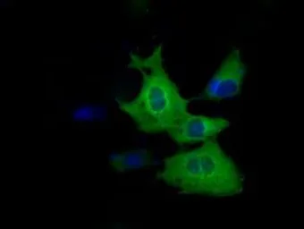 Anti-Tristetraprolin antibody [3D10] used in Immunocytochemistry/ Immunofluorescence (ICC/IF). GTX83405