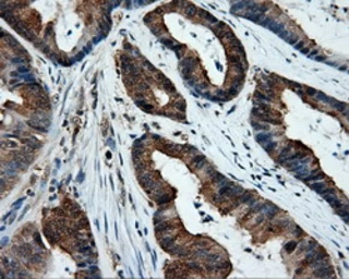 Anti-XRCC1 antibody [2D8] used in IHC (Paraffin sections) (IHC-P). GTX83411