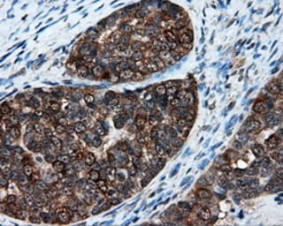 Anti-XRCC1 antibody [2D8] used in IHC (Paraffin sections) (IHC-P). GTX83411