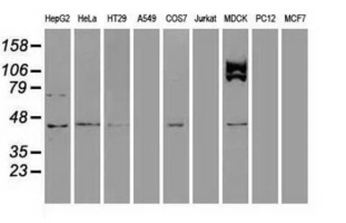 Anti-USP38 antibody [1D11] used in Western Blot (WB). GTX83434