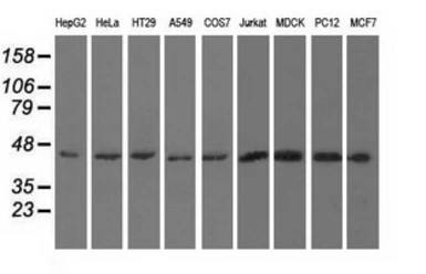 Anti-UHMK1 antibody [5E10] used in Western Blot (WB). GTX83440