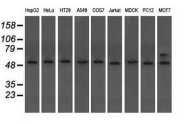 Anti-alpha Tubulin 8 antibody [3E10] used in Western Blot (WB). GTX83463