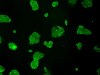 Anti-TTLL12 antibody [12B7] used in Immunocytochemistry/ Immunofluorescence (ICC/IF). GTX83471