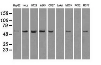 Anti-TMEM100 antibody [1F8] used in Western Blot (WB). GTX83507