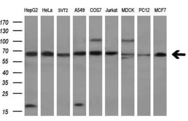Anti-Transketolase antibody [5H3] used in Western Blot (WB). GTX83510