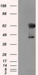 Anti-Transketolase antibody [5H3] used in Western Blot (WB). GTX83510