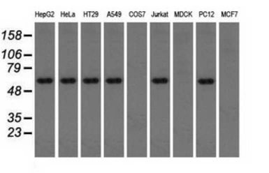 Anti-TXA synthase antibody [2C1] used in Western Blot (WB). GTX83523