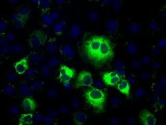 Anti-TXA synthase antibody [2C1] used in Immunocytochemistry/ Immunofluorescence (ICC/IF). GTX83523
