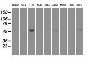 Anti-STK39 antibody [2E10] used in Western Blot (WB). GTX83543