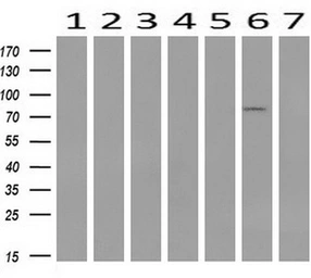 Anti-STAT1 antibody [4H9] used in Western Blot (WB). GTX83552