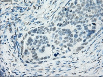 Anti-SSX2 antibody [4A11] used in IHC (Paraffin sections) (IHC-P). GTX83554