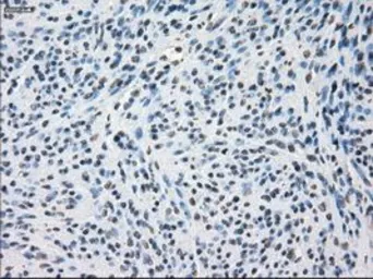 Anti-SSX2 antibody [4A11] used in IHC (Paraffin sections) (IHC-P). GTX83554