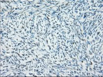 Anti-SSX2 antibody [4A11] used in IHC (Paraffin sections) (IHC-P). GTX83554