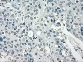 Anti-SSX2 antibody [4D10] used in IHC (Paraffin sections) (IHC-P). GTX83555