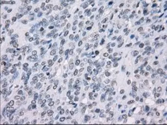 Anti-SSX2 antibody [4D10] used in IHC (Paraffin sections) (IHC-P). GTX83555
