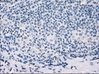Anti-SSX2 antibody [4D10] used in IHC (Paraffin sections) (IHC-P). GTX83555