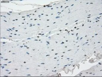 Anti-SSX2 antibody [4D10] used in IHC (Paraffin sections) (IHC-P). GTX83555