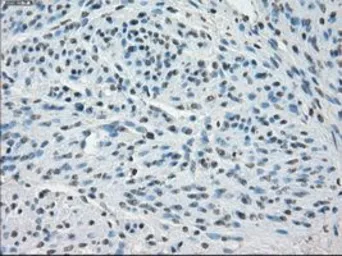 Anti-SSX2 antibody [4D10] used in IHC (Paraffin sections) (IHC-P). GTX83555