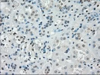 Anti-SSX2 antibody [4D10] used in IHC (Paraffin sections) (IHC-P). GTX83555