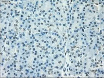 Anti-SSX2 antibody [4D10] used in IHC (Paraffin sections) (IHC-P). GTX83555