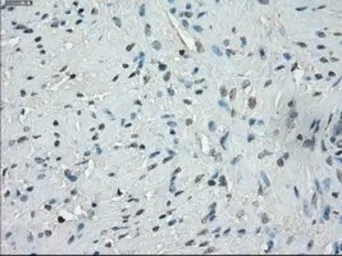 Anti-SSX2 antibody [4D10] used in IHC (Paraffin sections) (IHC-P). GTX83555