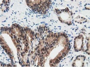 Anti-SSSCA1 antibody [2F5] used in IHC (Paraffin sections) (IHC-P). GTX83556