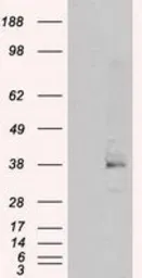 Anti-Serine racemase antibody [9E8] used in Western Blot (WB). GTX83567