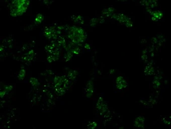 Anti-Serine racemase antibody [9E8] used in Immunocytochemistry/ Immunofluorescence (ICC/IF). GTX83567