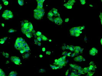 Anti-Sorbitol Dehydrogenase antibody [1D5] used in Immunocytochemistry/ Immunofluorescence (ICC/IF). GTX83588