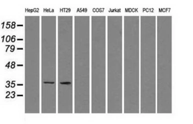 Anti-Sorbitol Dehydrogenase antibody [9E7] used in Western Blot (WB). GTX83589