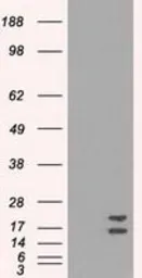 Anti-SOD1 antibody [8B10] used in Western Blot (WB). GTX83592