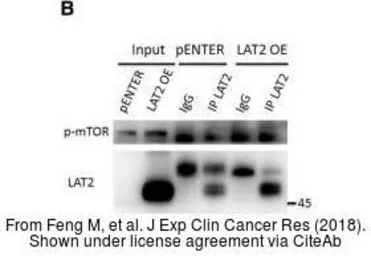 Anti-SLC7A8 antibody [5A9] used in Western Blot and Immunoprecipitation (WB IP). GTX83618