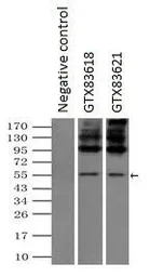 Anti-SLC7A8 antibody [5A9] used in Immunoprecipitation (IP). GTX83618