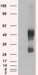 Anti-SLC7A8 antibody [5A9] used in Western Blot (WB). GTX83618