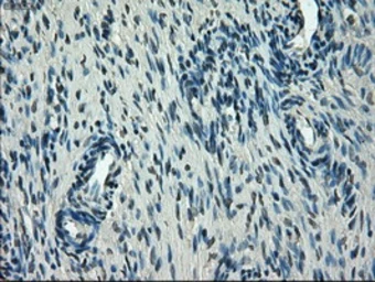 Anti-GLUT5 antibody [9F3] used in IHC (Paraffin sections) (IHC-P). GTX83628