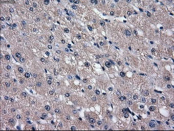Anti-GLUT5 antibody [20E1] used in IHC (Paraffin sections) (IHC-P). GTX83631