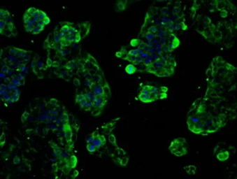 Anti-GLUT5 antibody [20E1] used in Immunocytochemistry/ Immunofluorescence (ICC/IF). GTX83631