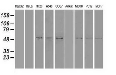 Anti-Shh antibody [10H6] used in Western Blot (WB). GTX83651