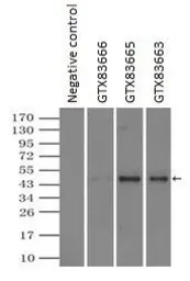 Anti-alpha 1 Antitrypsin antibody [11G2] used in Immunoprecipitation (IP). GTX83663