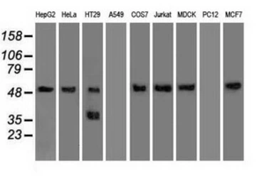 Anti-alpha 1 Antitrypsin antibody [11G2] used in Western Blot (WB). GTX83663